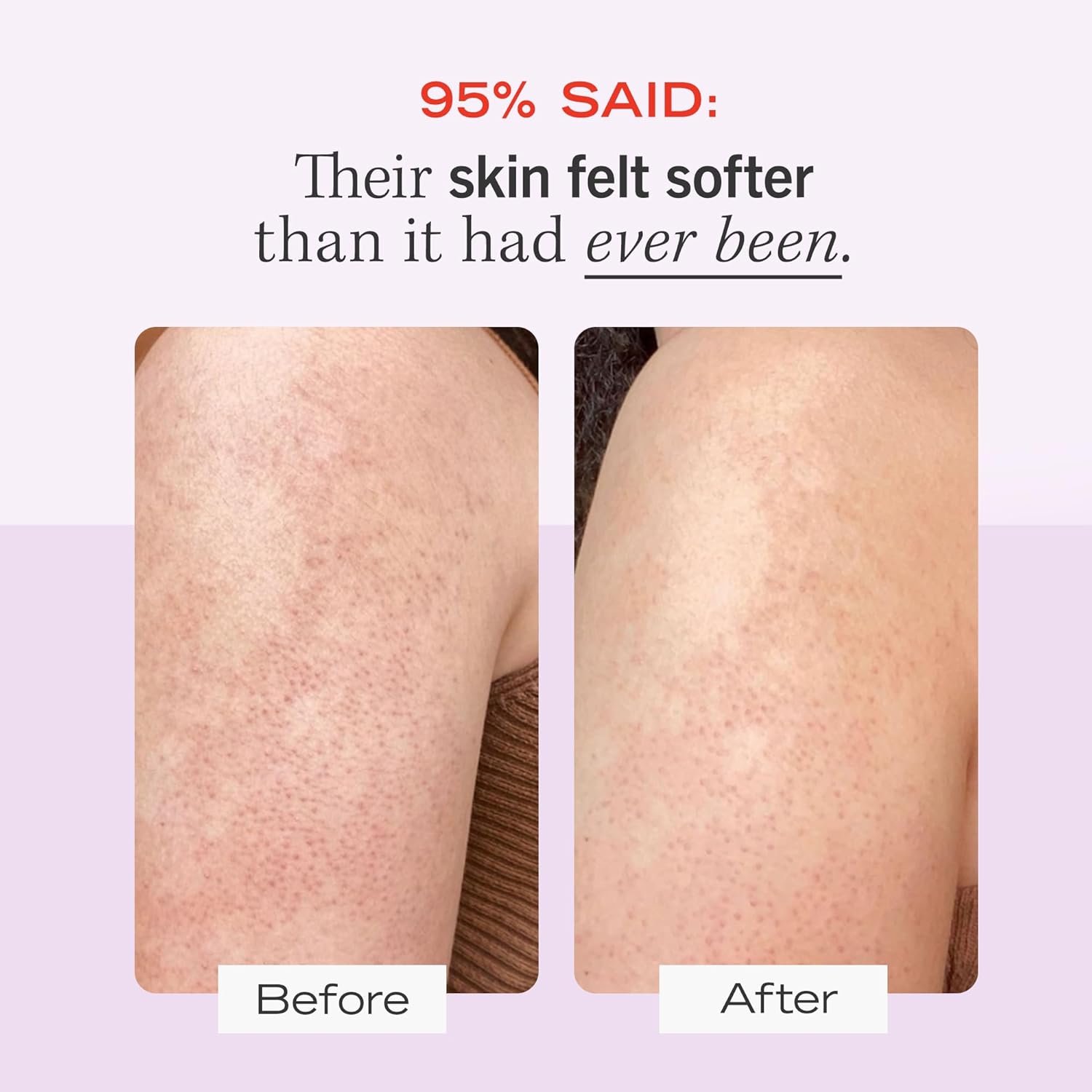 First Aid Beauty - KP Bump Eraser Body Scrub with 10% AHA, Keratosis Pilaris Skin Exfoliater with Glycolic and Lactic acids, Helps Reduce Chicken Skin Bumps, Safe for Sensitive Skin, 10 oz - Image 3