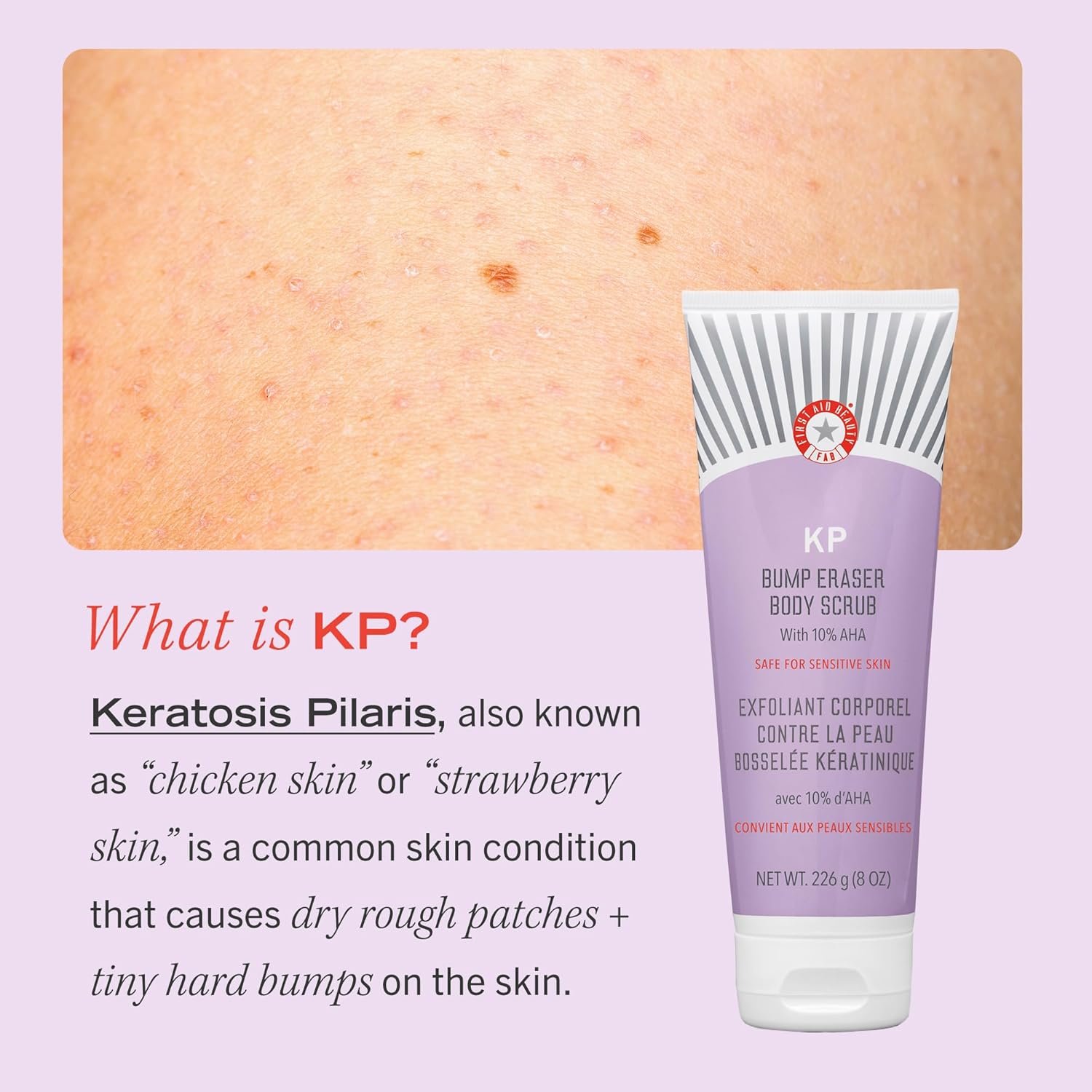 First Aid Beauty - KP Bump Eraser Body Scrub with 10% AHA, Keratosis Pilaris Skin Exfoliater with Glycolic and Lactic acids, Helps Reduce Chicken Skin Bumps, Safe for Sensitive Skin, 10 oz - Image 6