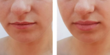 How Does Lip Care Change With Age?